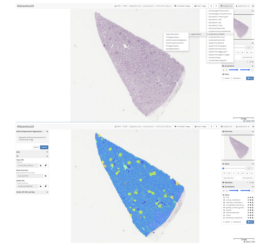 ComPRePS workflow and plugin/job UI (Figure 1 from the preprint)