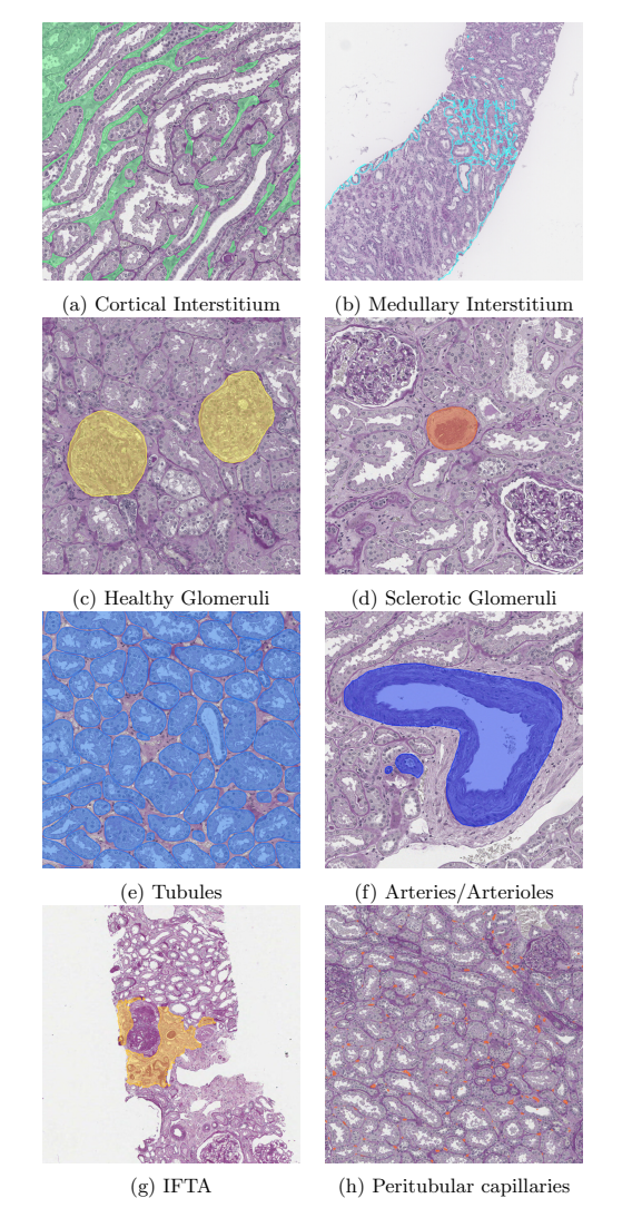 Multi-compartment segmentation outputs (Figure 2 from the preprint)